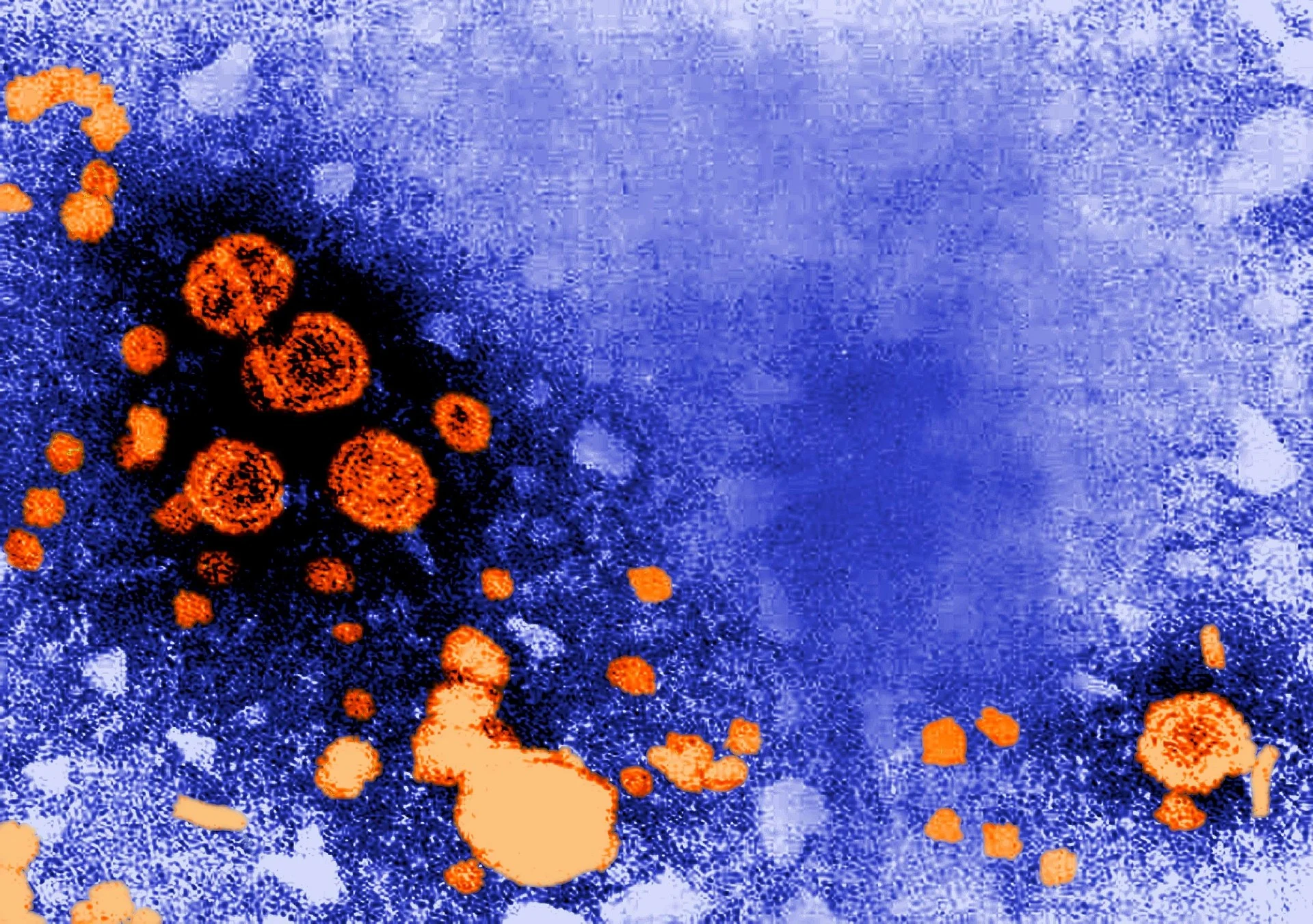 Hepatitis A